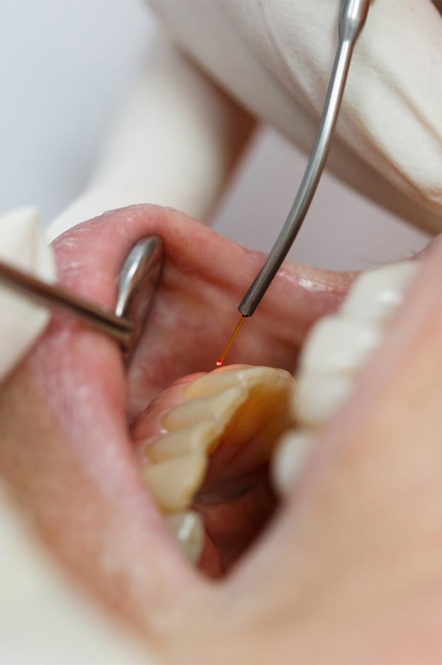 A person using a dental tool to meticulously clean their teeth, ensuring oral hygiene and health