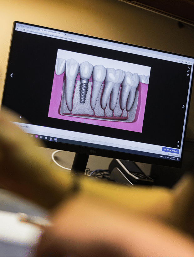 A person gazes at a computer screen displaying an image of a tooth